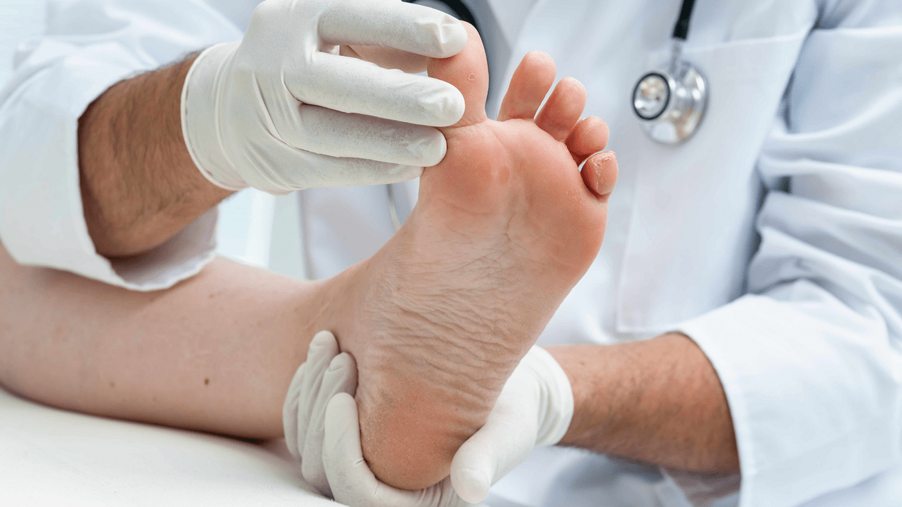 a lábak bőrének vizsgálata szakorvosi időpontban