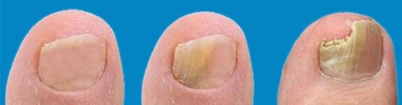 A gomba fejlődési folyamata