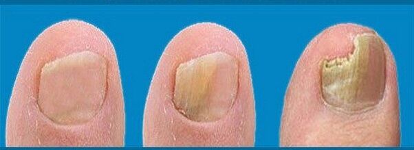 gombafejlődési folyamat